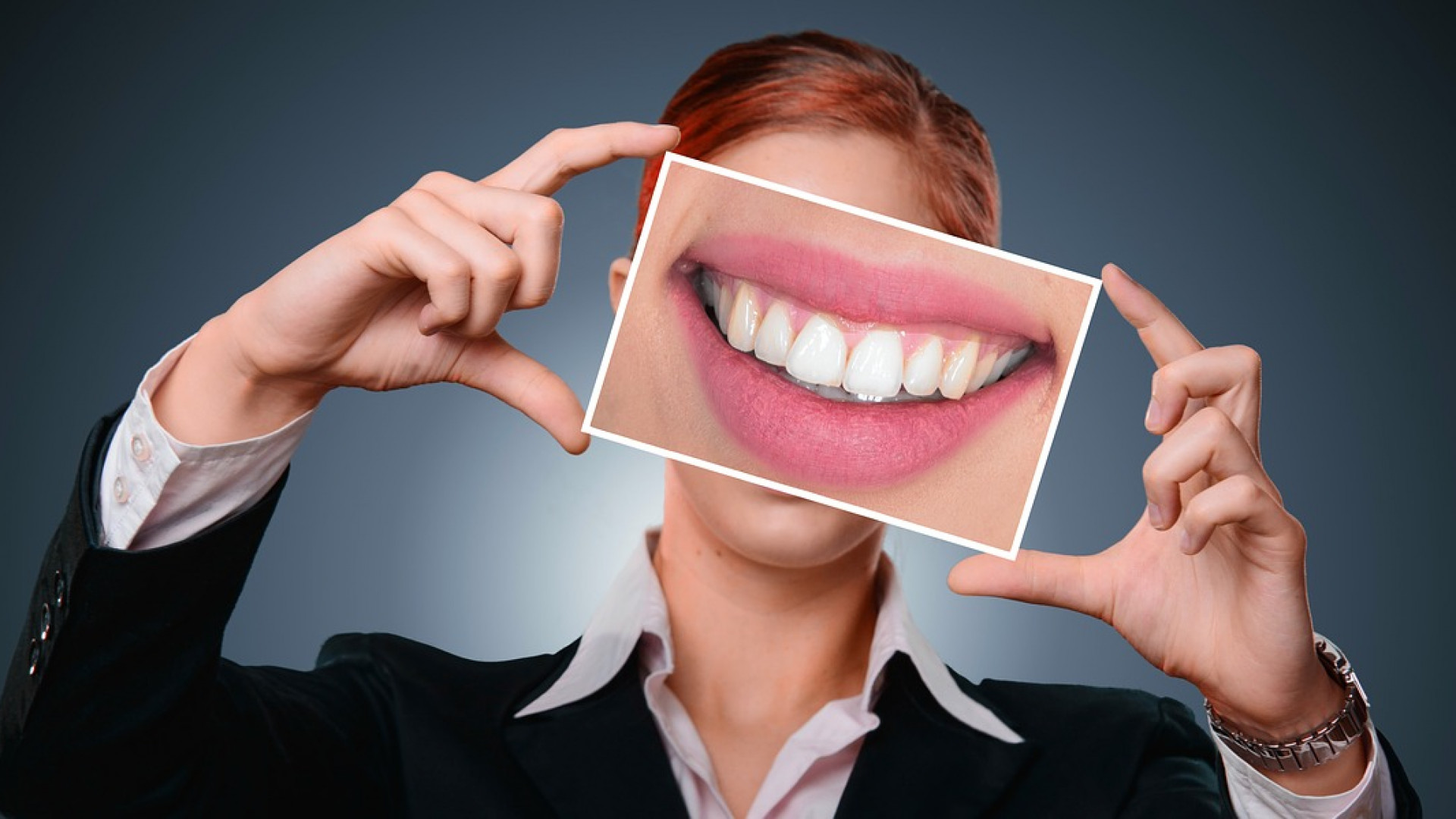 Retrouver le sourire avec les facettes dentaires