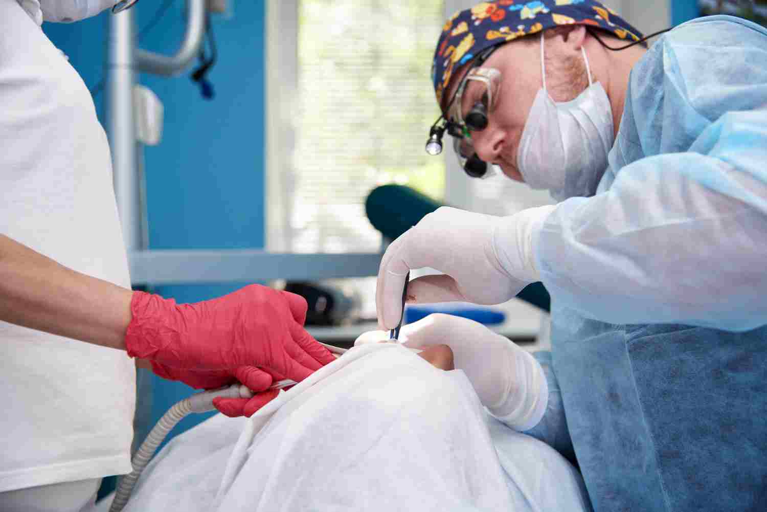 Combien de temps dure les douleurs après ablation vésicule