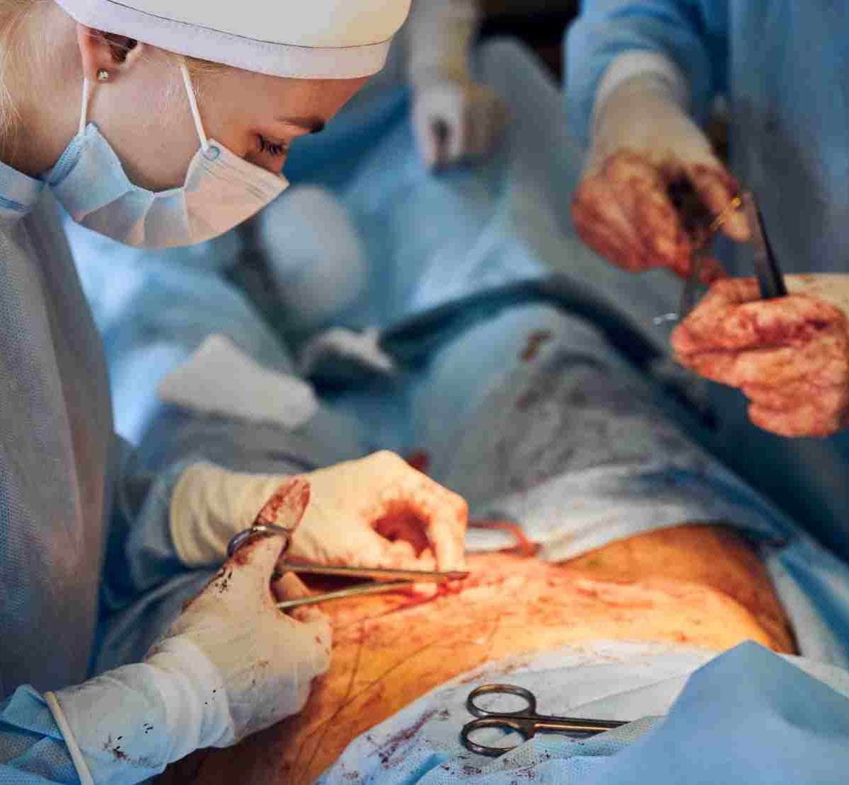 Combien de temps dure les douleurs après ablation vésicule
