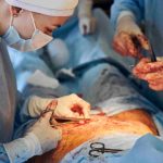 Combien de temps dure les douleurs après ablation vésicule